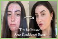How To Feel Confident With Acne?